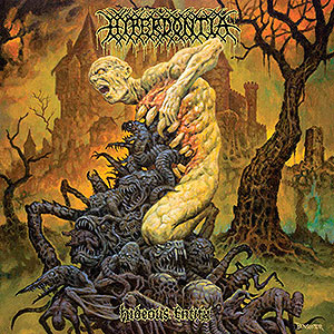 HYPERDONTIA - Hideous Entity