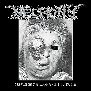 NECRONY - [black] Severe Malignant Pustule