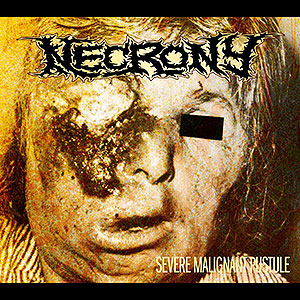 NECRONY - Severe Malignant Pustule