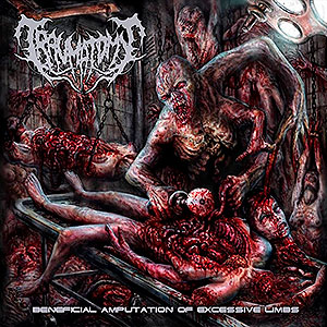 TRAUMATOMY - Beneficial Amputation of Excessive Limbs