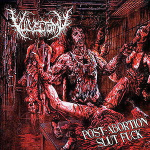 VULVECTOMY - Post-Abortion Slut Fuck