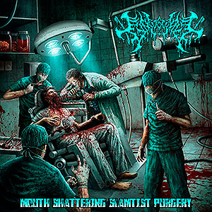 GINGIVECTOMY - Mouth Shattering Slamtist Purgery