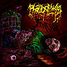 PHALLOPLASTY - Smear